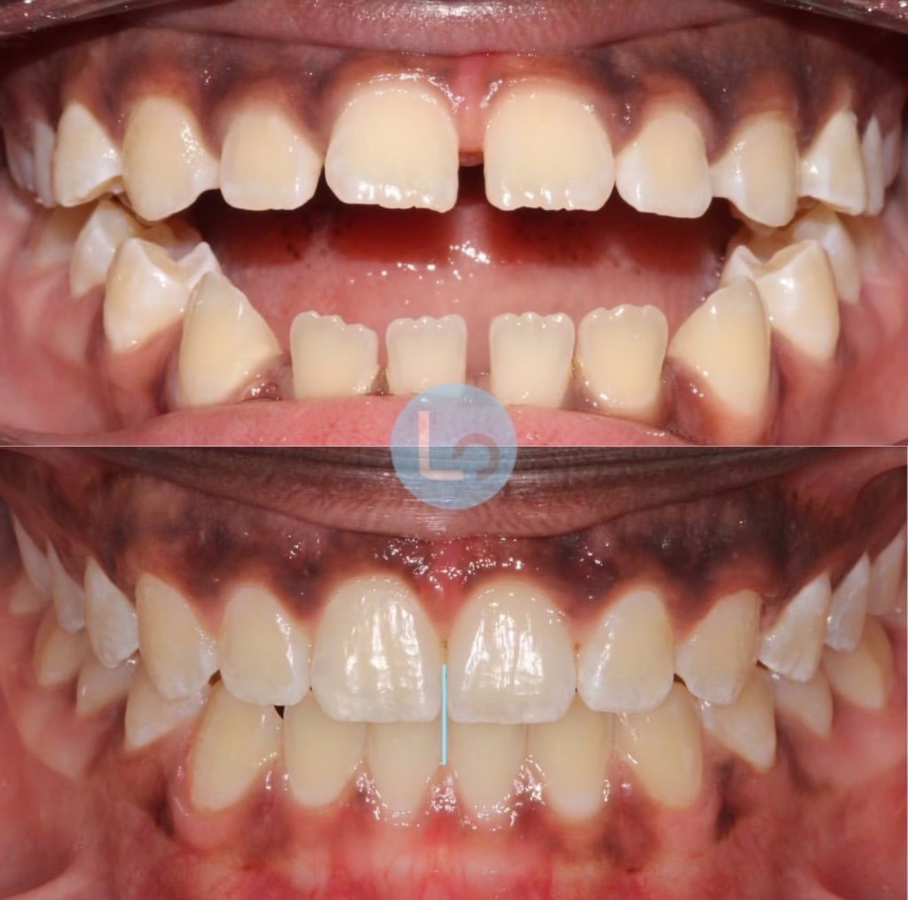 before and after