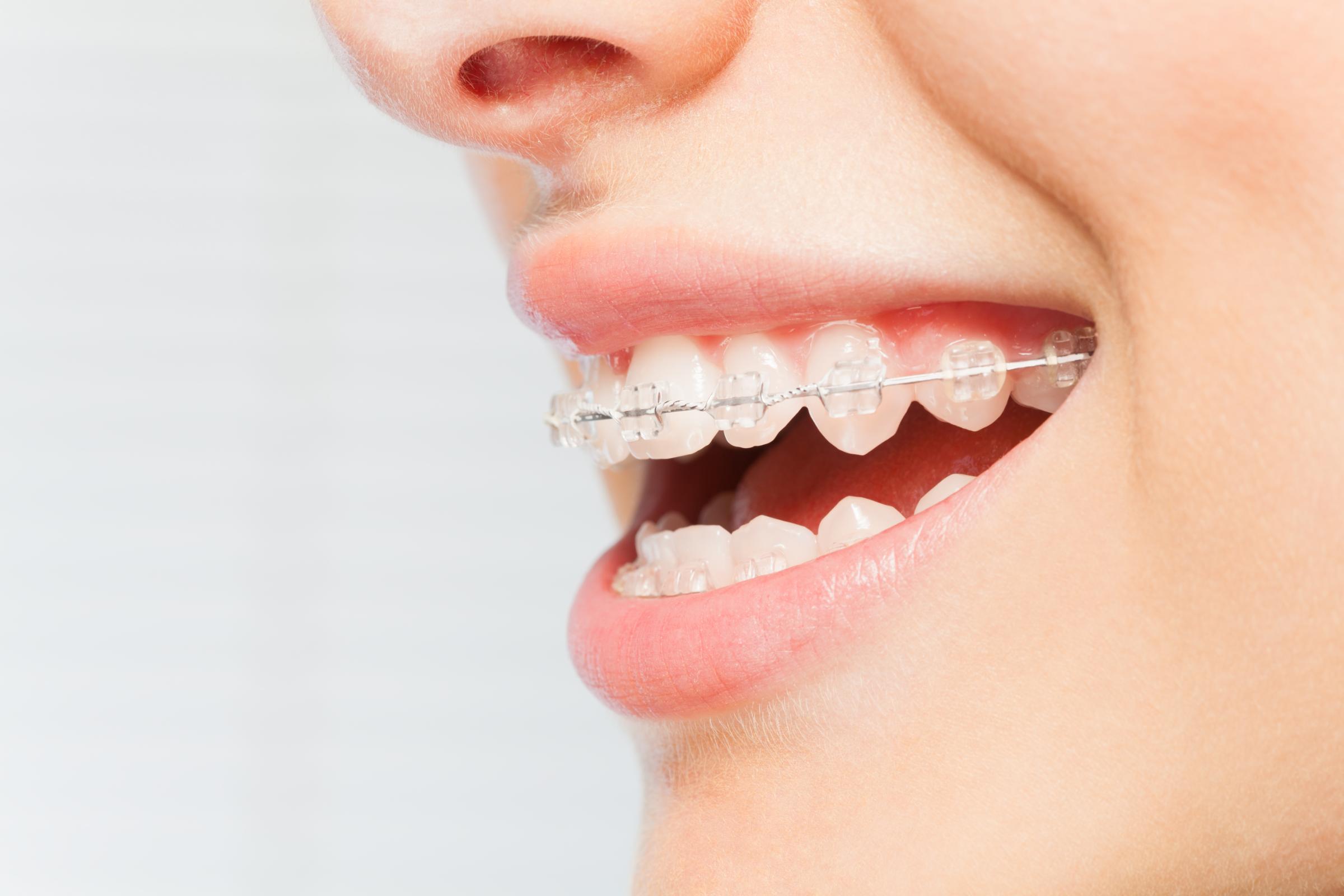 orthodontist sterling va