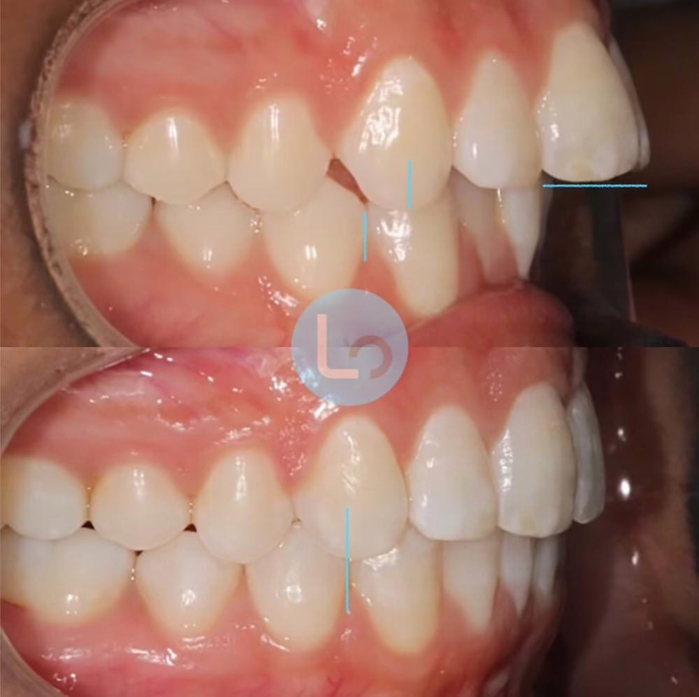 before and after photo