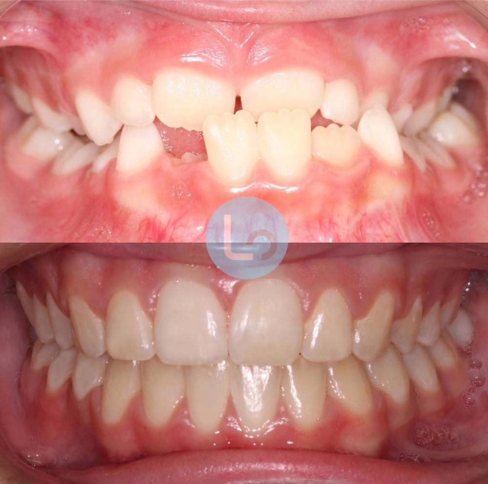 before and after photo
